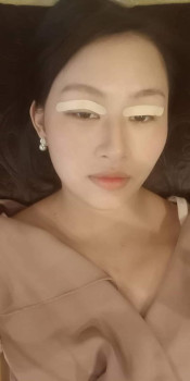 Mí em cắt được 7 ngày đây ạ