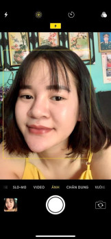 Chia sẻ quá trình trị mụn của Lê