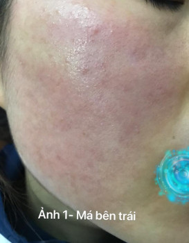 Các bước chăm sóc da có gì sai không?