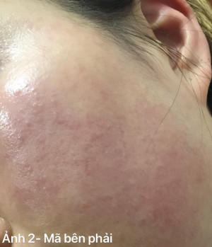 Các bước chăm sóc da có gì sai không?