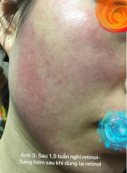 Các bước chăm sóc da có gì sai không?