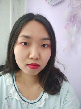 Từng bị chê bai vì má đầy mụn, cô gái đã thay đổi như thế này đây