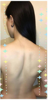 Từ cô nàng mụn lưng hóa thành hot girl gợi cảm nhờ đâu?