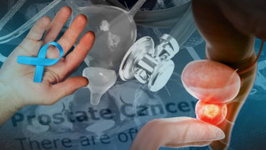 Các biến chứng của ung thư tuyến tiền liệt