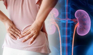 Nhiễm trùng thận: Nguyên nhân và điều trị
