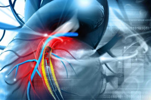 Bệnh tiểu đường và bệnh động mạch vành có mối liên hệ như thế nào?