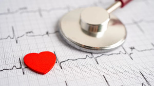 Rung nhĩ và rung nhĩ kịch phát: nguy cơ, triệu chứng, biến chứng và điều trị