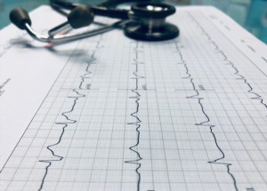 Rung nhĩ do bệnh van tim là gì?