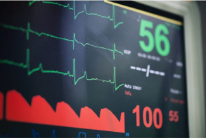 Nhịp tim chậm: Nguyên nhân và cách điều trị