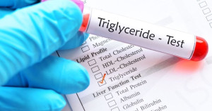 Nguyên nhân gây mức triglyceride cao là gì?