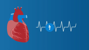 Hội chứng suy nút xoang là gì? Điều trị bằng cách nào?