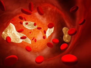 Mất bao lâu để có thể làm giảm cholesterol?