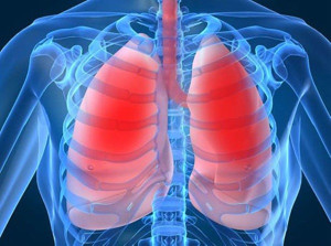Các triệu chứng của tăng áp động mạch phổi