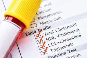 Triglyceride cao nhưng cholesterol lại bình thường là dấu hiệu của bệnh gì?