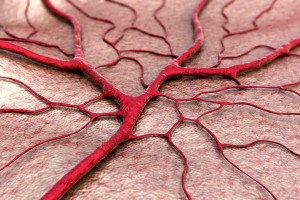 Sarcoma mạch máu: Triệu chứng, phương pháp điều trị và tiên lượng
