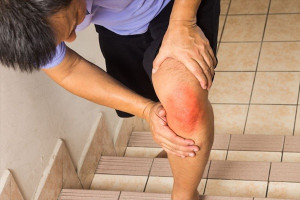 Bệnh cơ do statin: Triệu chứng và cách khắc phục