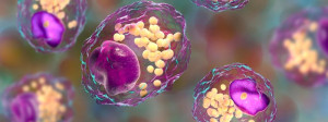 Tại sao kích thước hạt cholesterol lại quan trọng?