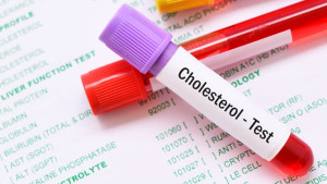 Non-HDL cholesterol là gì?