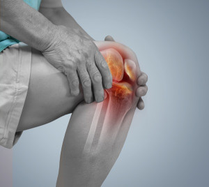 Viêm khớp: Triệu chứng, nguyên nhân và phương pháp điều trị