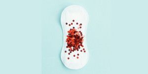 Tại sao lại bị chảy máu sau xét nghiệm Pap smear và bao lâu thì hết?
