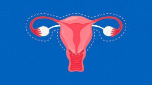 Cắt tử cung sẽ để lại sẹo ở đâu?