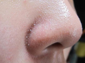 Vì Sao Nên Căng Da Nách? Giải Pháp Cho Làn Da Săn Chắc và Tự Tin Hơn