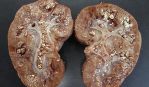 Cách dùng kem dưỡng da cho trẻ nhỏ