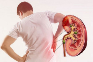 Cách phòng ngừa bệnh suy thận