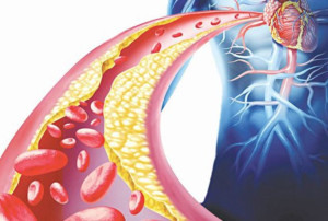 Bác sĩ hướng dẫn cách chăm sóc người bệnh bị viêm da cơ địa