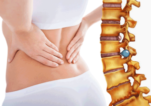 Người bị thoát vị đĩa đệm thắt lưng nên làm gì để bớt đau?
