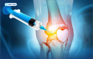 Tiêm PRP – Giải pháp tái tạo tự thân cho cơ xương khớp hiệu quả vượt trội