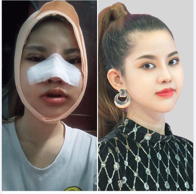 ĐẸP chất Hàn Quốc - Chi phí "Việt" - có đúng mong muốn chị em?