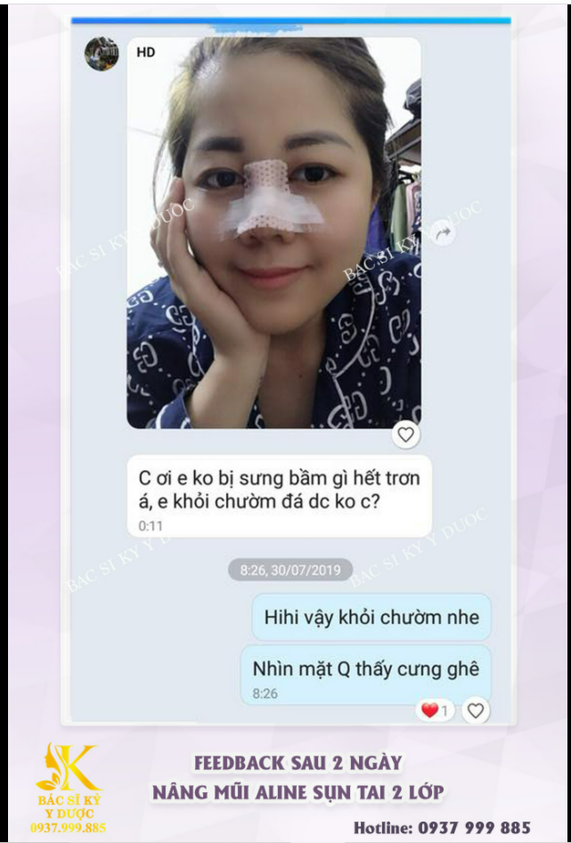HẠN CHẾ SƯNG BẦM - HẠN CHẾ ĐAU NHỨC SAU KHI MỔ ​​​​​​​ Kỹ thuật cao cấp ĐỘC QUYỀN tại Bác sĩ Kỳ Y Dược.