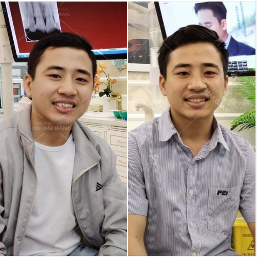 LÀM ĐẸP CHO SOÁI CA