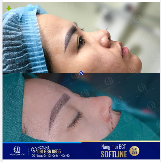 MÊ CHỮ Ê KÉO DÀI VỚI DÁNG MŨI BCT SOFTLINE