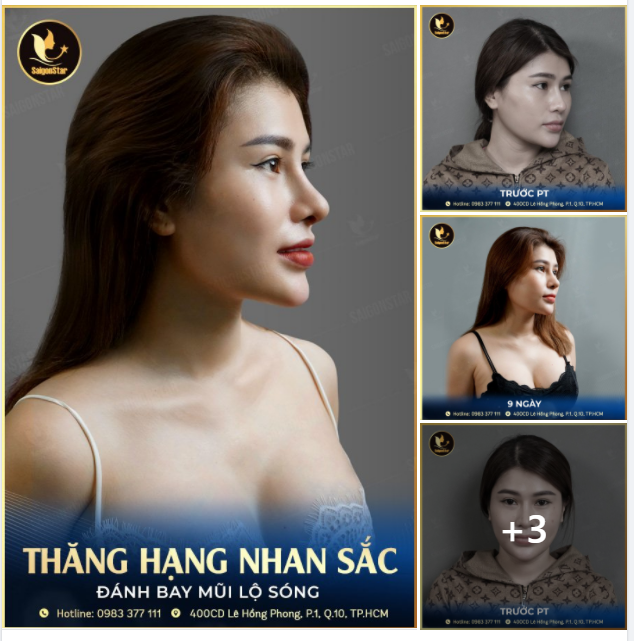 MŨI XINH LÀ PHẢI TỰ NHIÊN NÂNG MŨI SỬA LẠI, NÂNG CẤP NHAN SẮC LÊN MỘT TẦM CAO MỚI