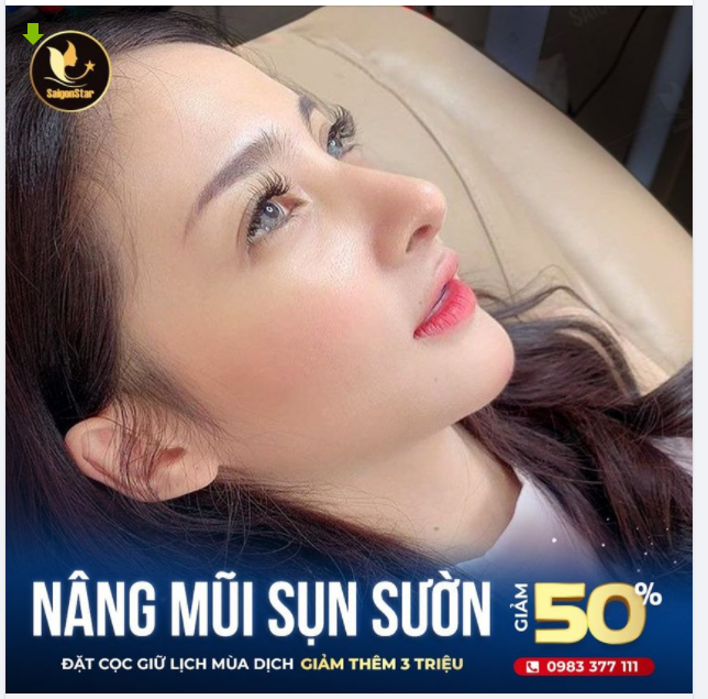 ​​​​​​​ NÂNG MŨI SỤN SƯỜN BÁC SĨ HOẠT – NÂNG LÀ ĐẸP