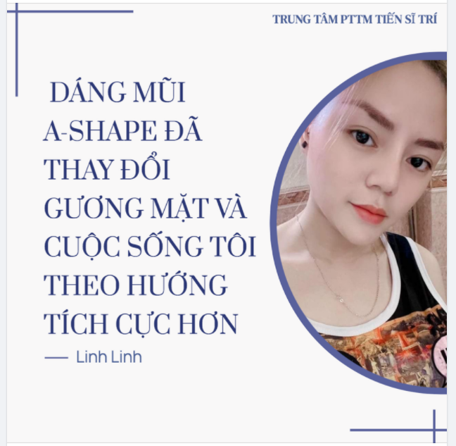NÂNG MŨI TẠI DR TRÍ - CHÂN ÁI CHO NHỮNG CA MŨI SỬA LẠI