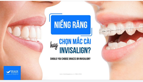 NIỀNG RĂNG MẮC CÀI VÀ INVISALIGN: SO SÁNH TRÊN 5 YẾU TỐ CHÍNH