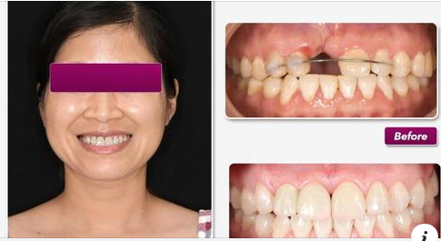 Nụ cười là đầu câu chuyện, là những ấn tượng khó phai để lại cho người đối diện