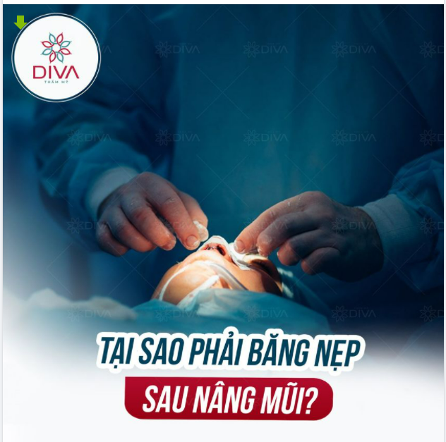 TẠI SAO PHẢI BĂNG NẸP SAU NÂNG MŨI ?