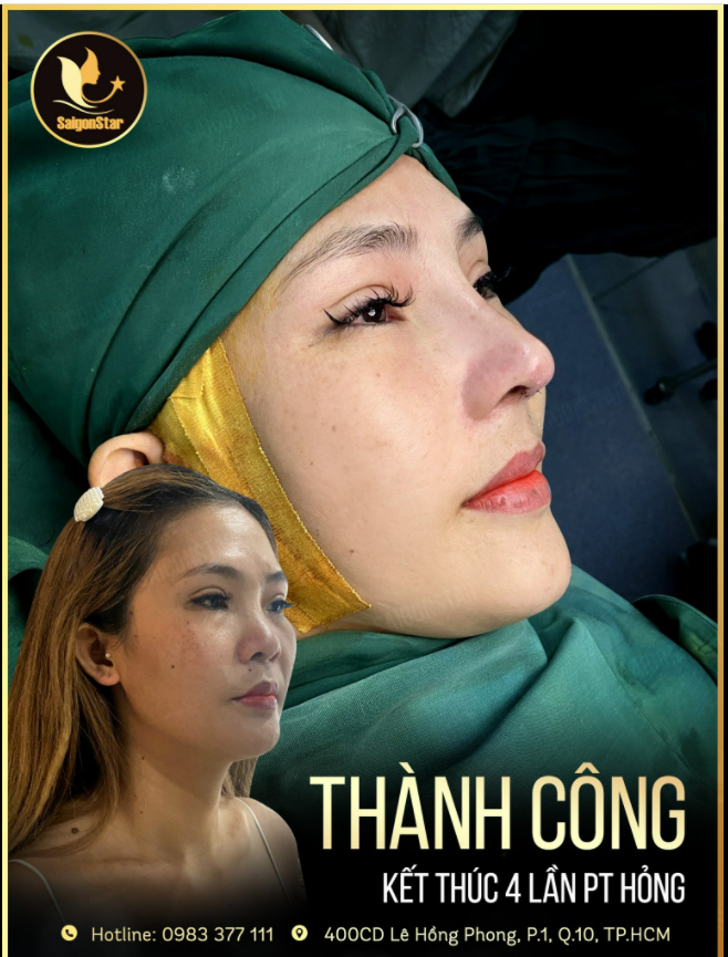 THÀNH CÔNG - KẾT THÚC 4 LẦN PT HỎNG
