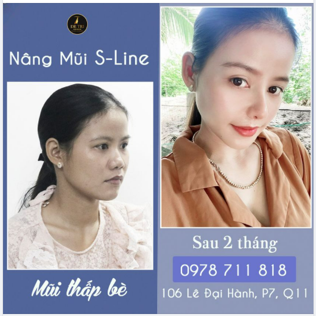 THAY ĐỔI MỘT CHÚT LẠI KHIẾN BẢN THÂN TỰ TIN HƠN