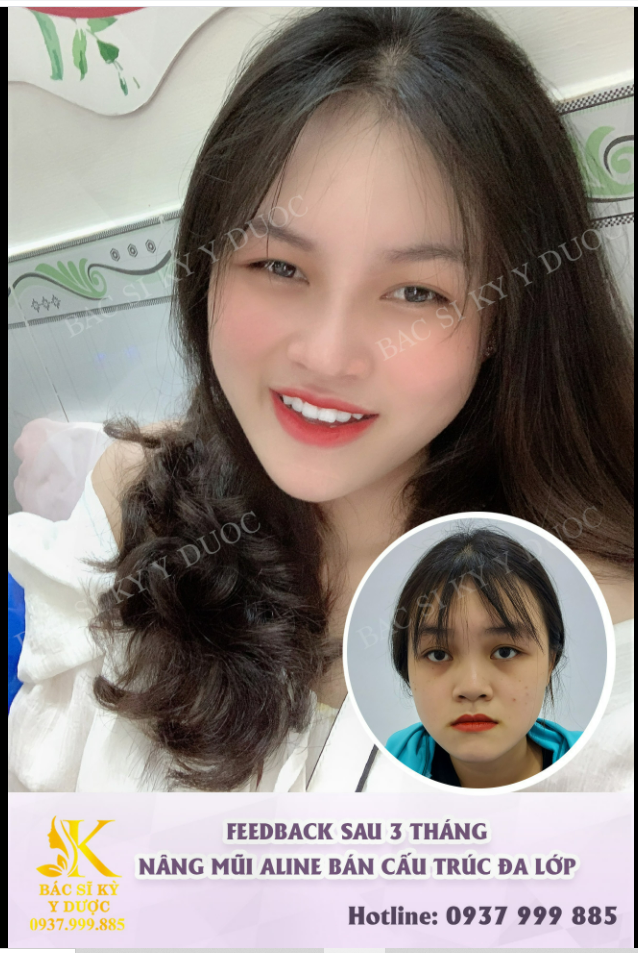 THAY ĐỔI TOÀN DIỆN SAU 3 THÁNG.