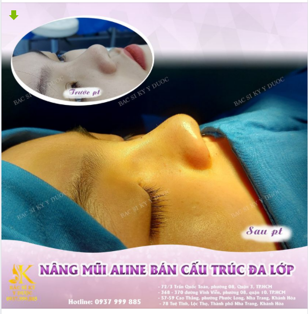 TỰ NHIÊN XINH ĐẸP - CÙNG DÁNG ALINE.