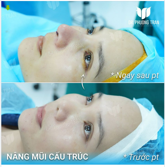 ĐỪNG TRÌ HOÃN SỰ XINH ĐẸP NÀY LẠI