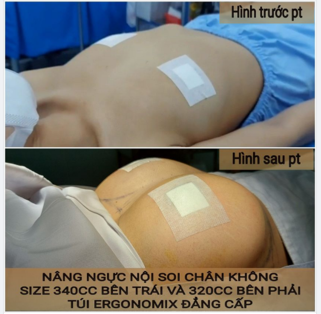 Hô biến mặt phẳng thành đồi núi