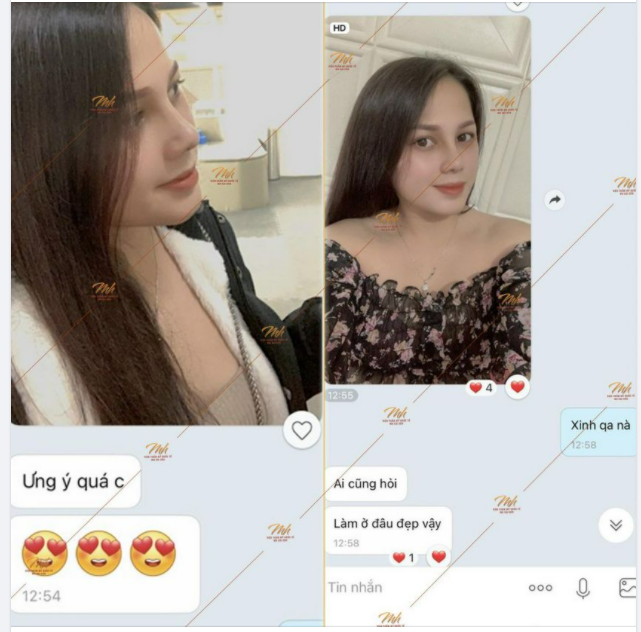 Khách hàng nâng mũi nè cả nhà ơi!
