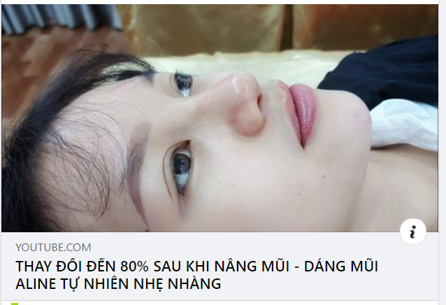 LỰA CHỌN NÂNG MŨI CÙNG BÁC SĨ KỲ Y DƯỢC - CHỌN NÉT ĐẸP BỀN LÂU.