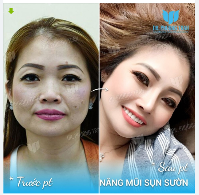 Ngoài trời đang yên ắng bỗng chốc đổ cơn mưa Em cười tươi như nắng, anh đã đổ em chưa